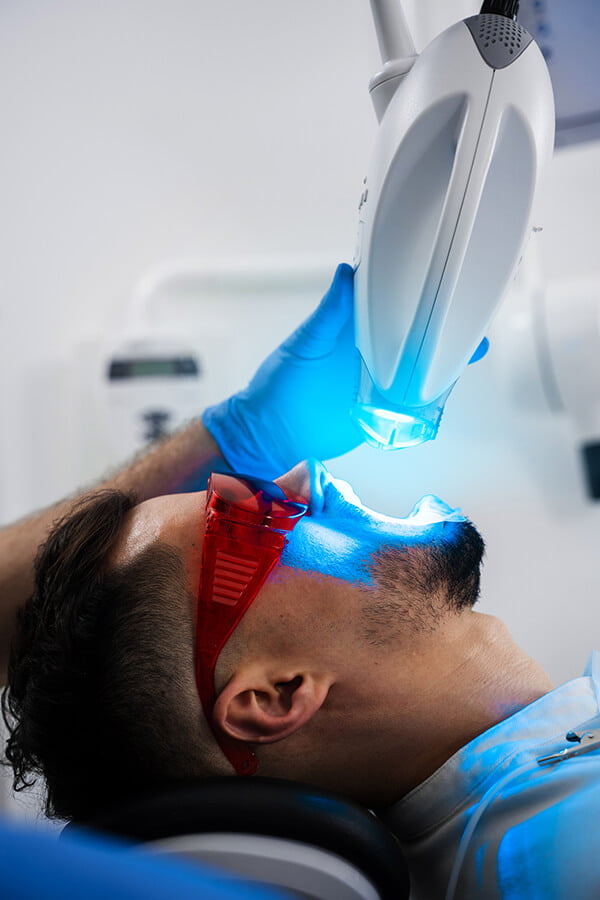 Teeth Whitening Options at Bayview Smile Centre