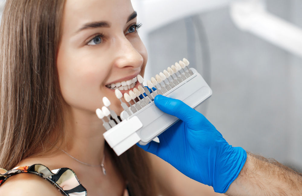 Porcelain Veneers Cost in Toronto and Canada