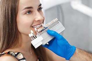 Porcelain Veneers Cost in Toronto and Canada