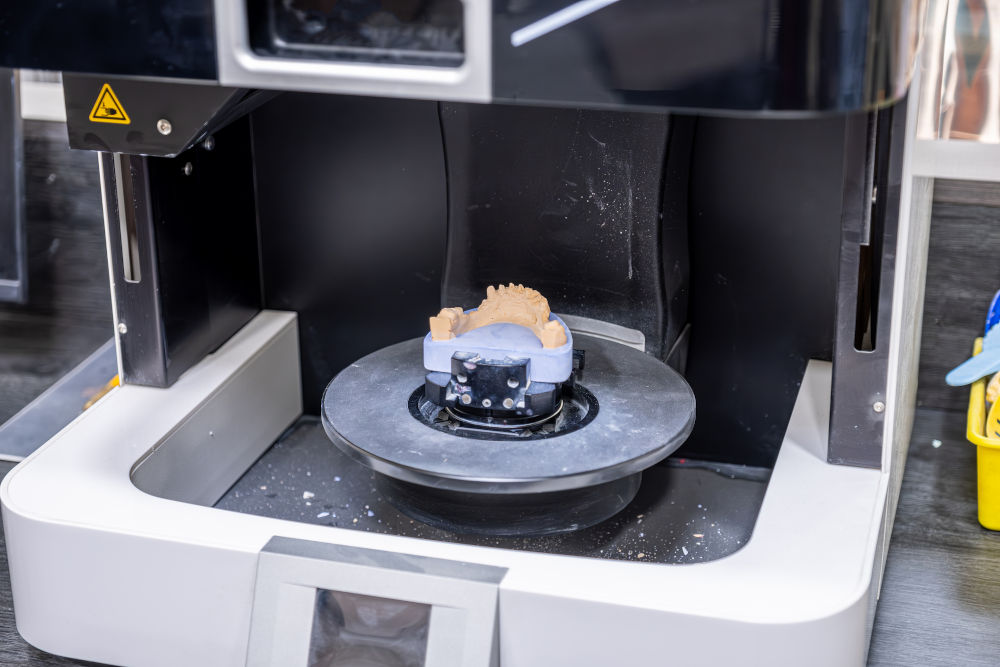 Digital dental scanner creating 3D model for precise crown fabrication